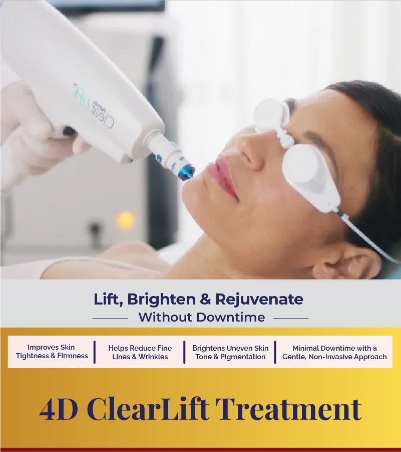 4D clearLift treatment