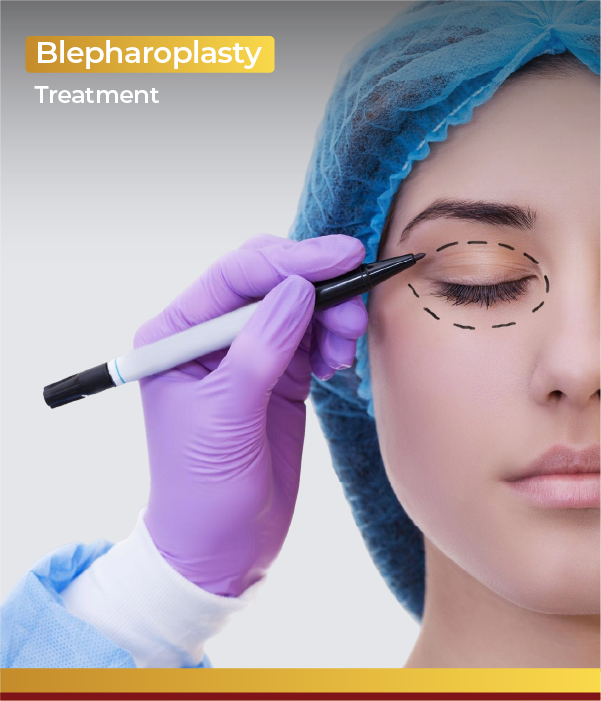 Blepharoplasty