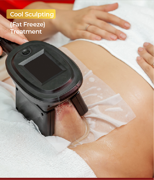 CoolSculpting Treatment