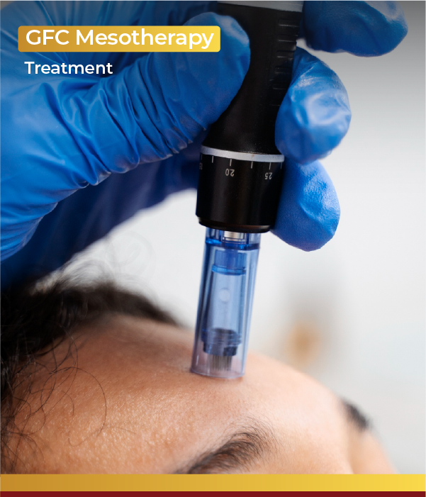 GFC Mesotherapy Treatment
