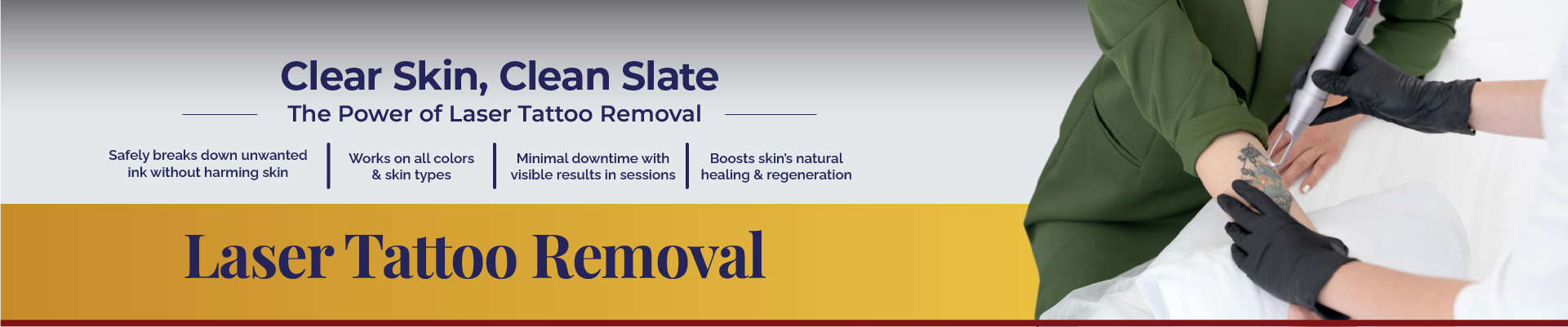 Laser Tattoo Removal