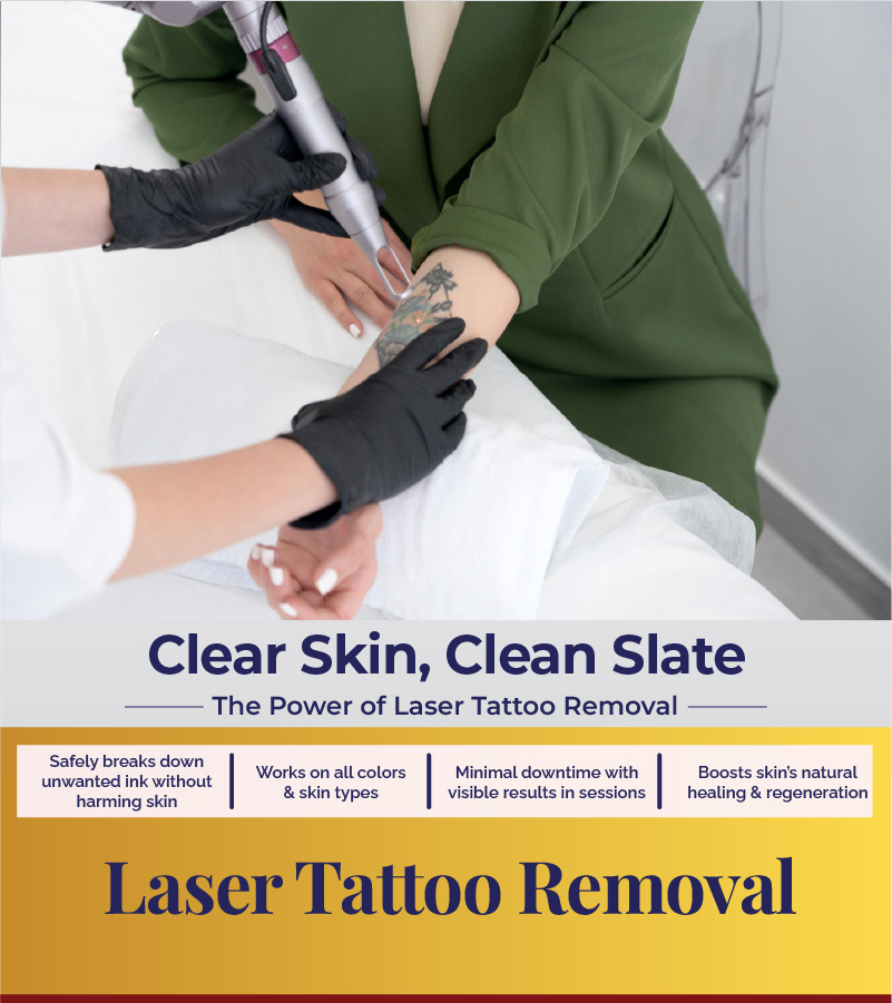 Laser Tattoo Removal