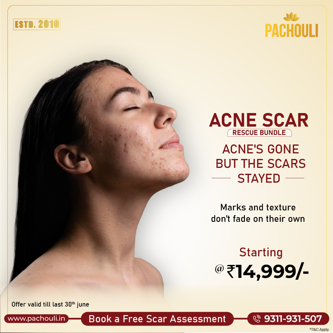acne scar rescue bundle 14999 offers