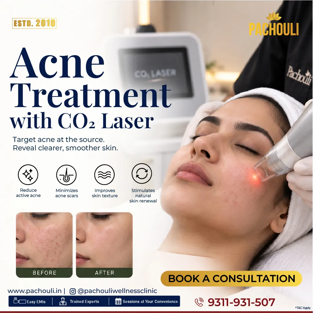 acne treatment co2 laser