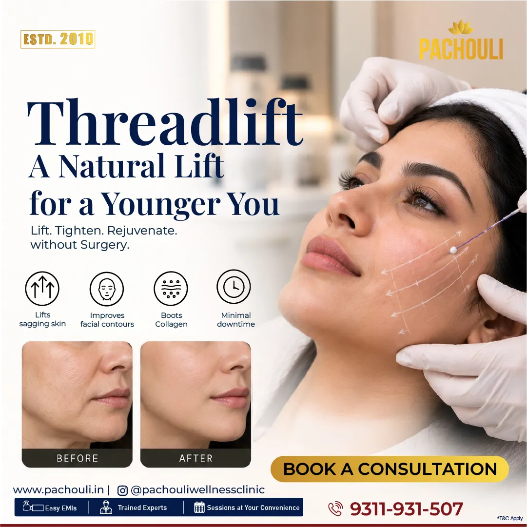 threadlift