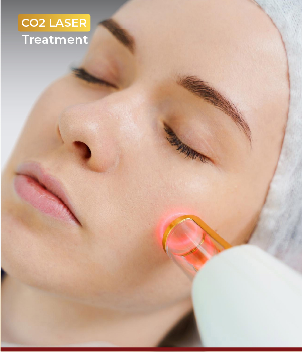 CO2 Laser Skin Treatment