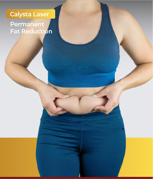 Calysta Laser Fat Reduction