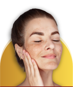pachouli jaipur pigmentation